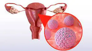 Human Papillomavirus