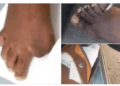 At Zimbwabwe Citizens Sell Toes In Dollars To Get Rich