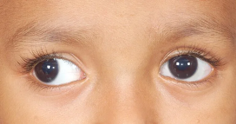 World Sight Day