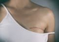 UK Transgender Surgeon