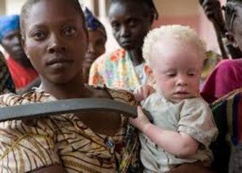 National Albinism Day